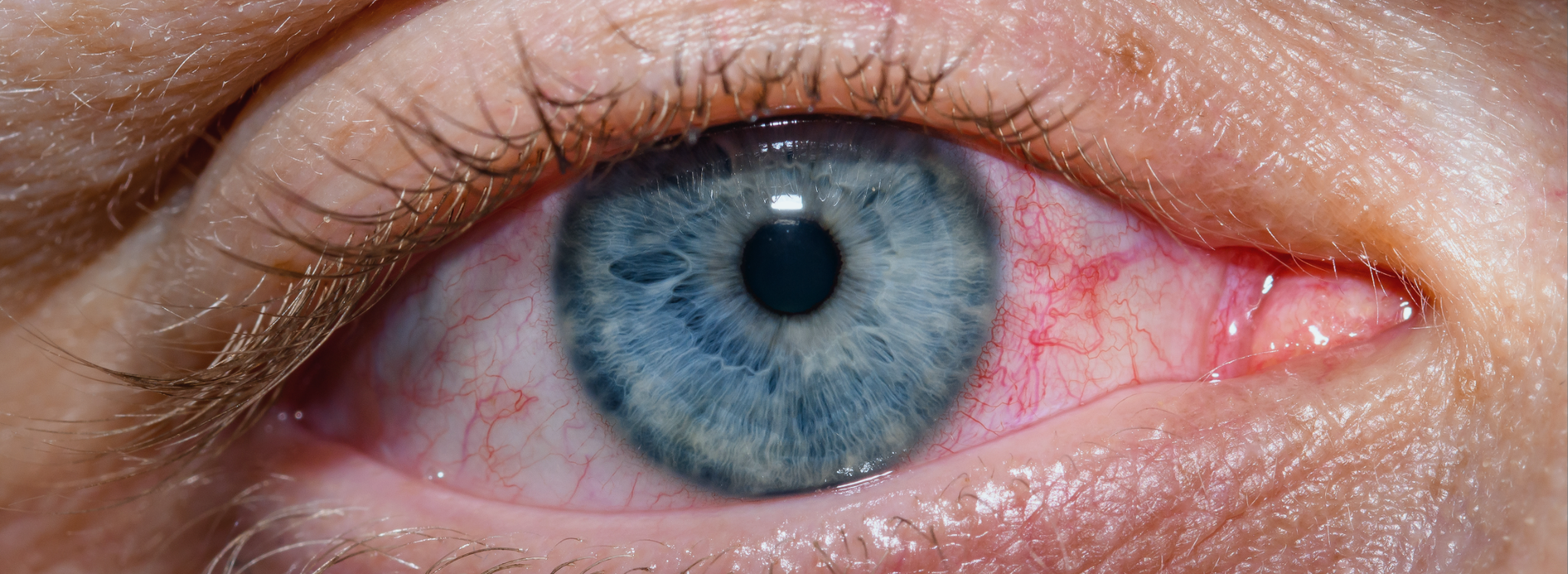 Ojos rojos